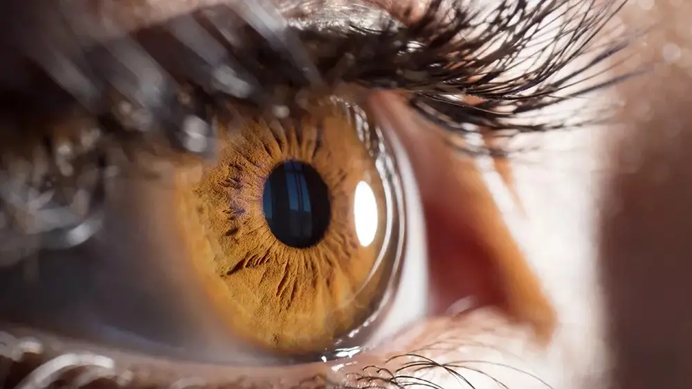 Εξόφθαλμος: Τι τον προκαλεί και πώς αντιμετωπίζεται;